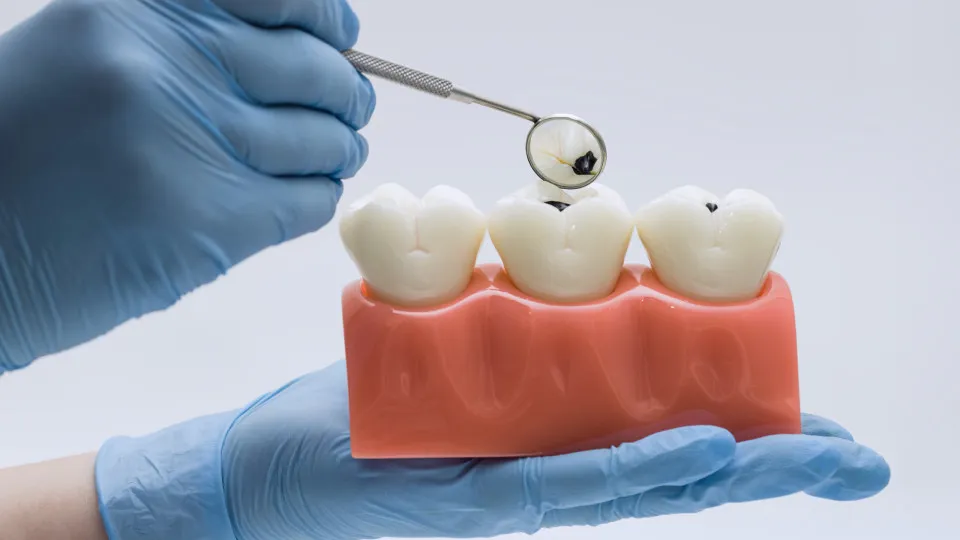 Alimentos “inofensivos” podem destruir o esmalte dos dentes; veja 7