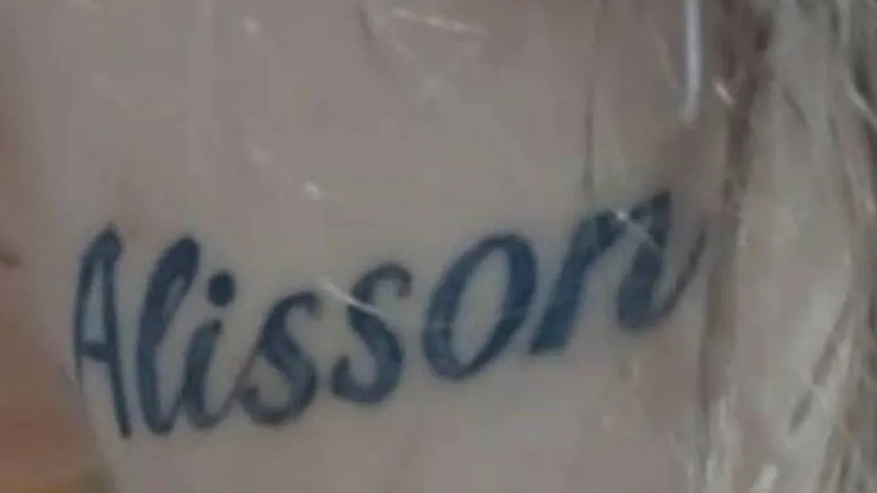 Dentista é preso suspeito de forçar companheira a tatuar o nome dele dez vezes em SC 1