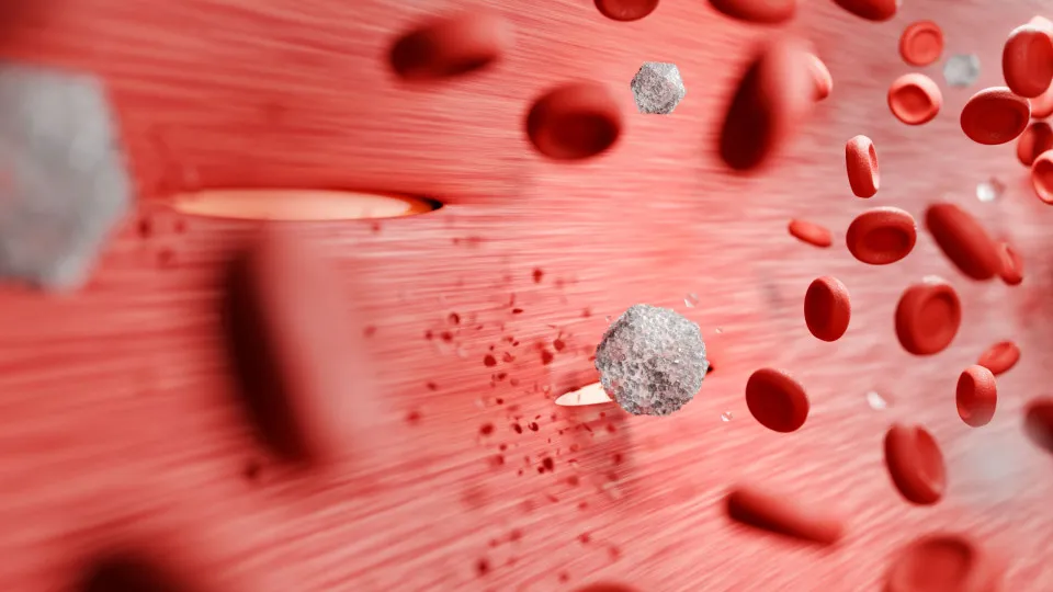7 hábitos simples para controlar o açúcar no sangue no dia a dia 5