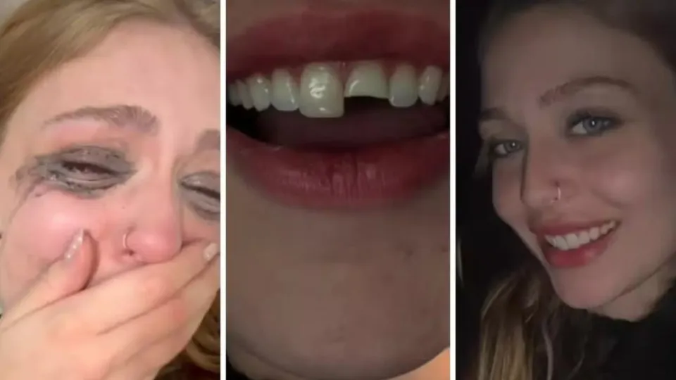 Jovem quebra dente na balada no PR, cola na madrugada e volta para a festa 12