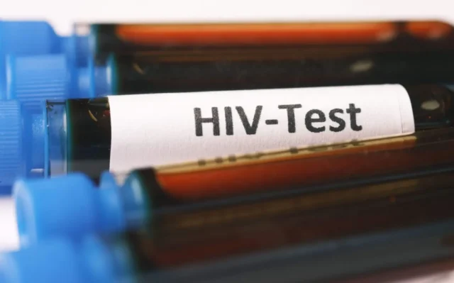 As lacunas de testes de HIV em jovens gays, segundo este estudo 15