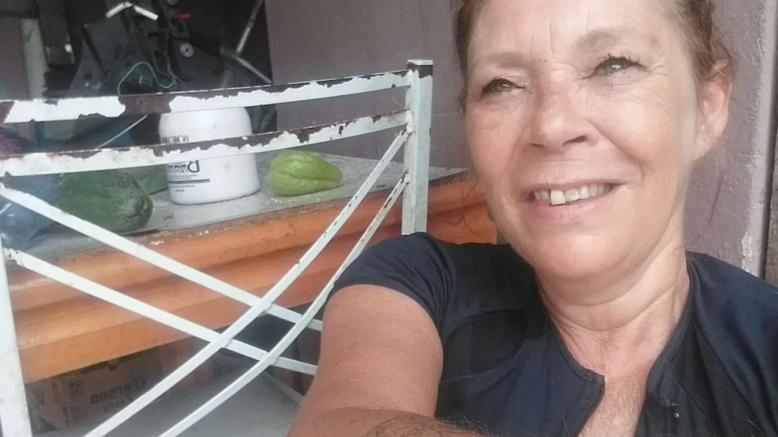 Mulher que teria atedao fogo no próprio corpo morre no hospital 1