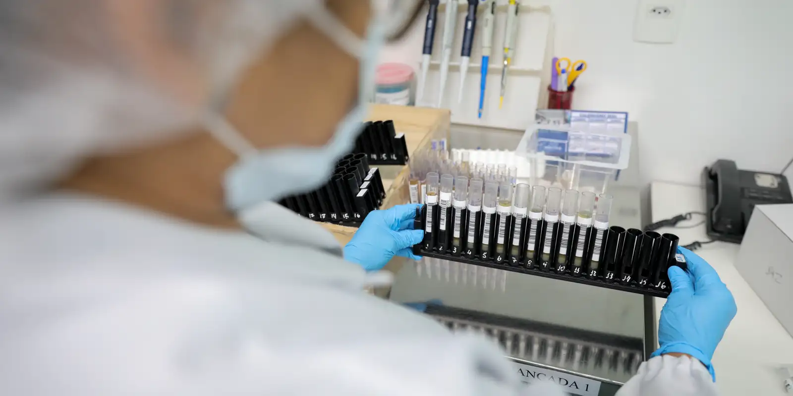 Malária: Anvisa autoriza teste em humanos de vacina 100% brasileira 1