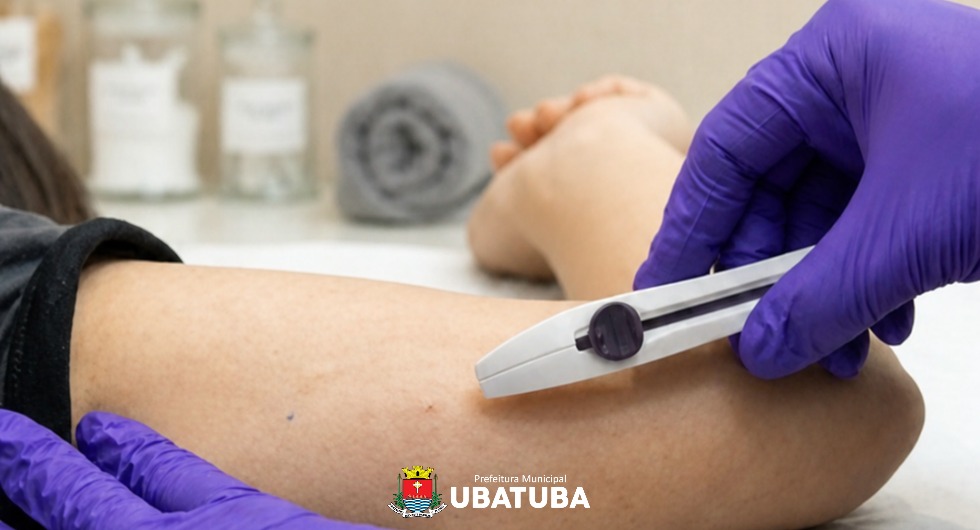 Saúde promove capacitação de enfermeiros para implante de anticoncepcional – Prefeitura Municipal de Ubatuba 1